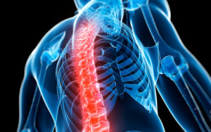osteoporosis